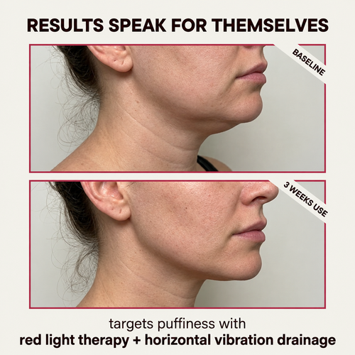 Lymphatic Drainage Massager — "The Gua Shua On Steroids"