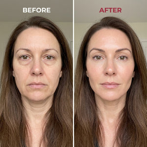 The Gua Sha On Steroids